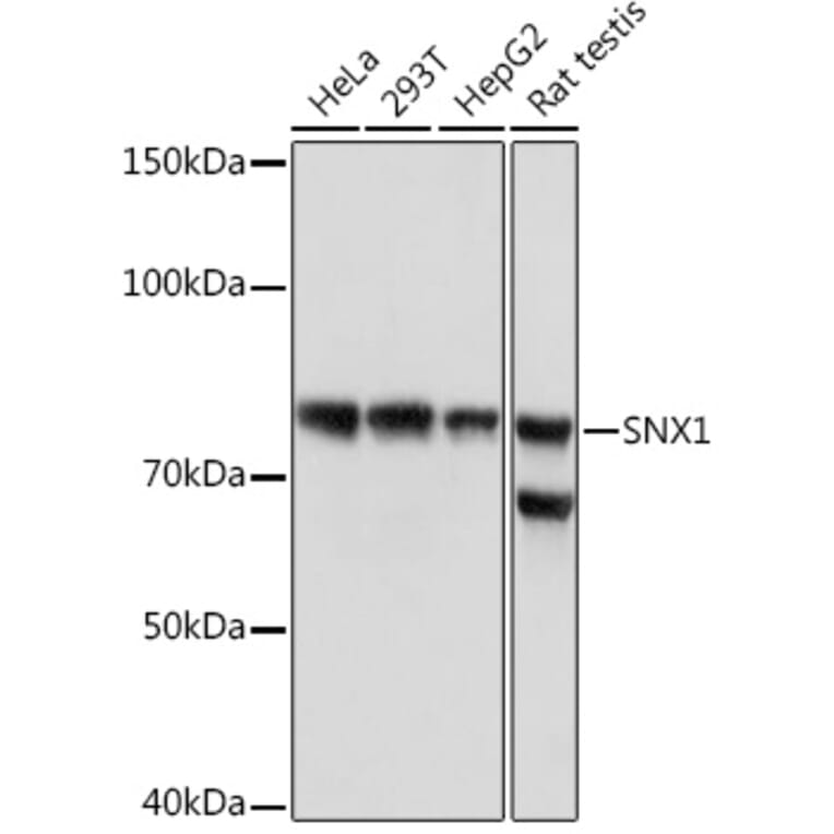 Western Blot - Anti-SNX1 Antibody [ARC1969] (A307010) - Antibodies.com