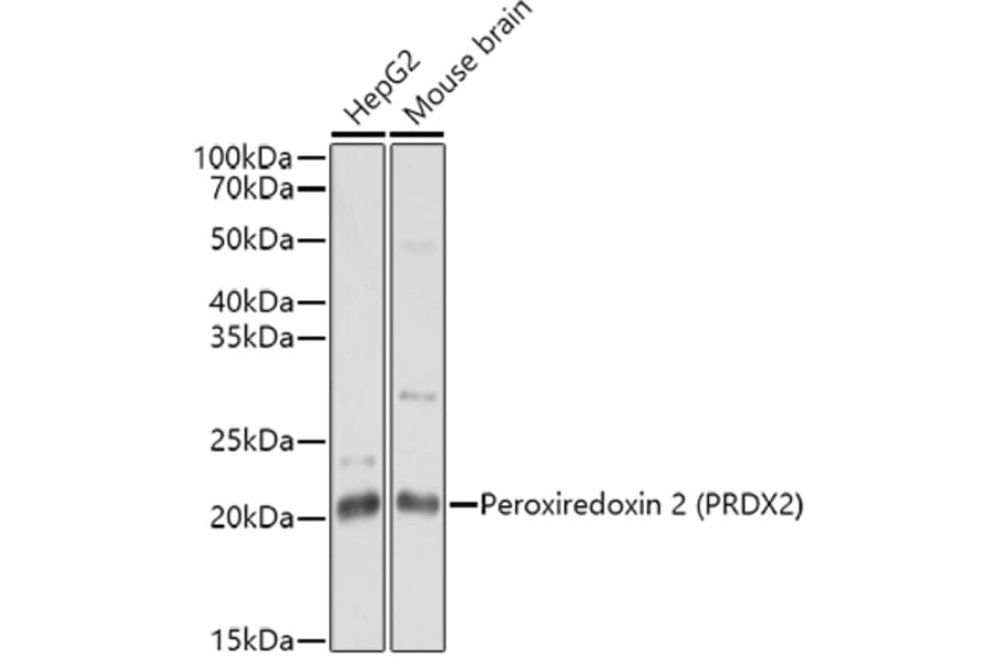 Western Blot - Anti-Peroxiredoxin 2/PRP Antibody (A307013) - Antibodies.com