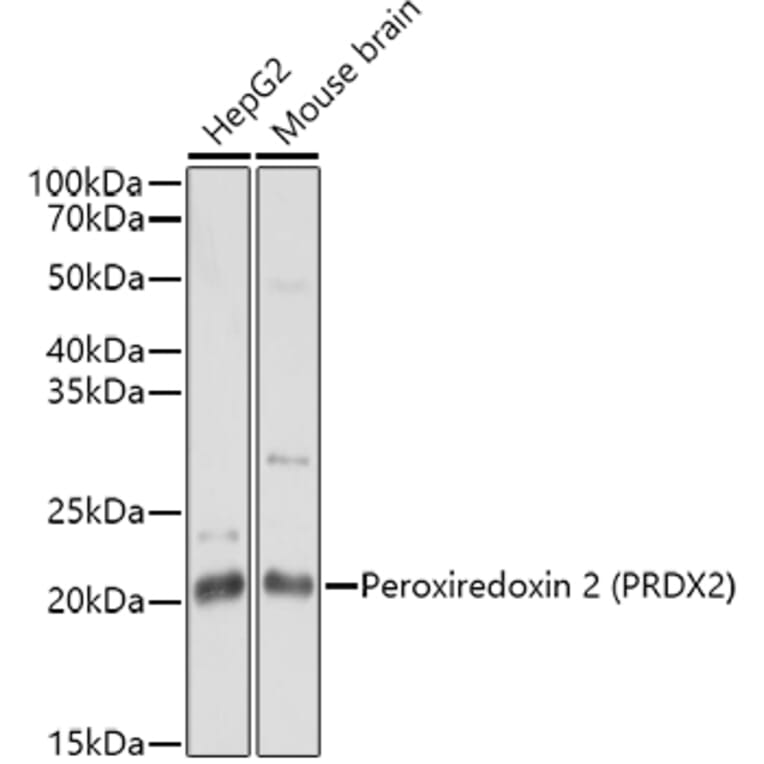 Western Blot - Anti-Peroxiredoxin 2/PRP Antibody (A307013) - Antibodies.com