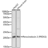 Western Blot - Anti-Peroxiredoxin 2/PRP Antibody (A307013) - Antibodies.com