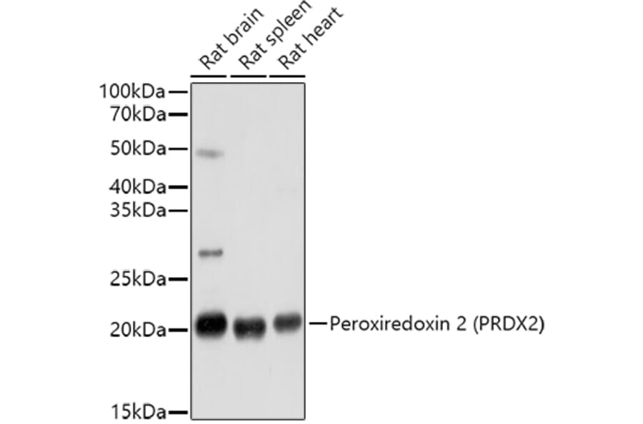 Western Blot - Anti-Peroxiredoxin 2/PRP Antibody (A307013) - Antibodies.com