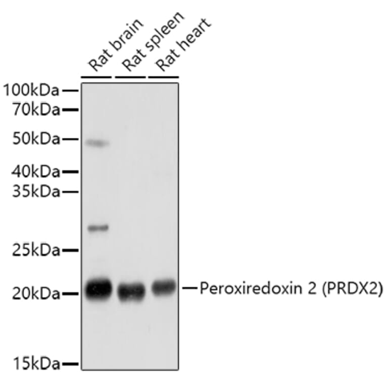 Western Blot - Anti-Peroxiredoxin 2/PRP Antibody (A307013) - Antibodies.com