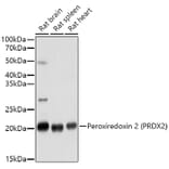 Western Blot - Anti-Peroxiredoxin 2/PRP Antibody (A307013) - Antibodies.com