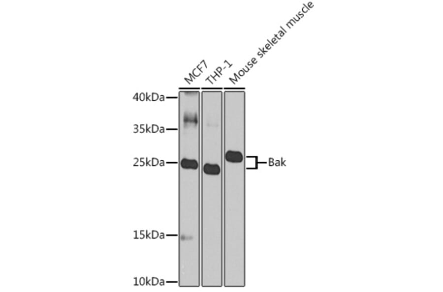 Western Blot - Anti-Bak Antibody (A307014) - Antibodies.com