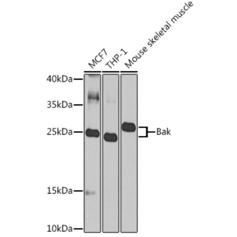 Western Blot - Anti-Bak Antibody (A307014) - Antibodies.com