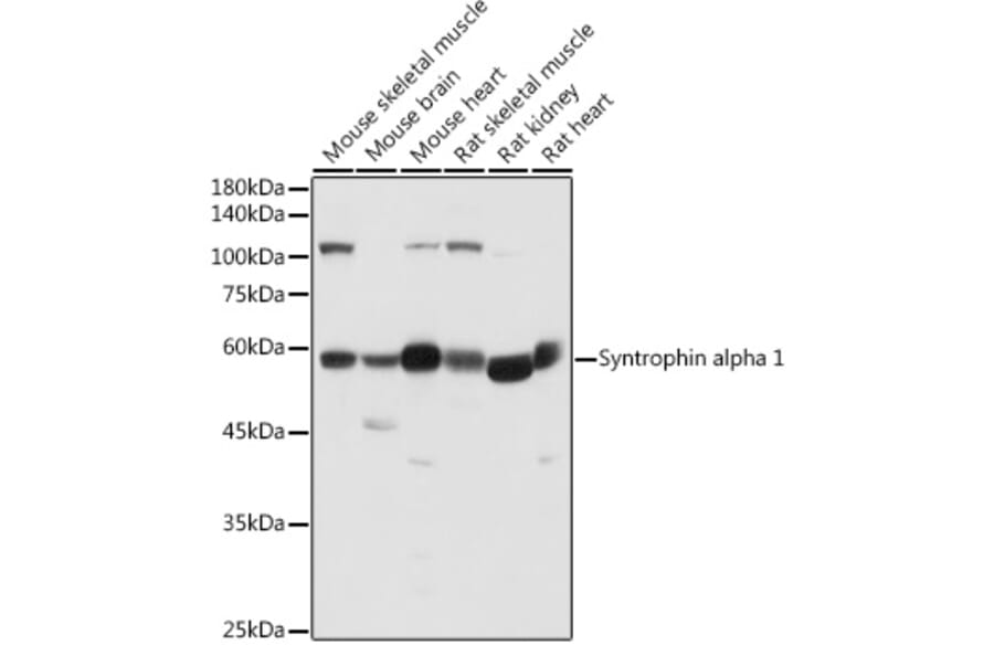 Western Blot - Anti-Syntrophin alpha 1 Antibody (A307015) - Antibodies.com