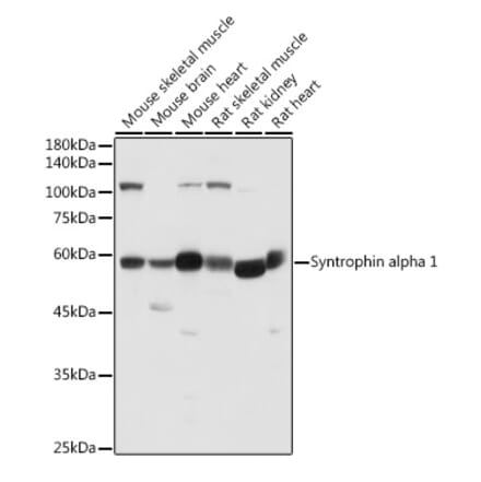 Western Blot - Anti-Syntrophin alpha 1 Antibody (A307015) - Antibodies.com