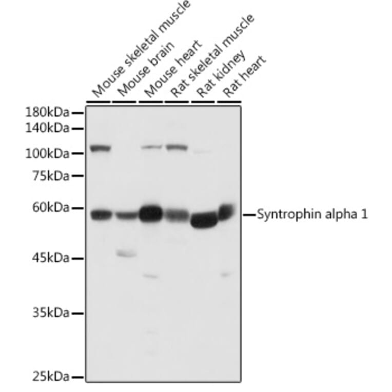 Western Blot - Anti-Syntrophin alpha 1 Antibody (A307015) - Antibodies.com