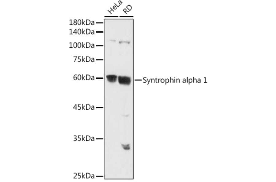 Western Blot - Anti-Syntrophin alpha 1 Antibody (A307015) - Antibodies.com