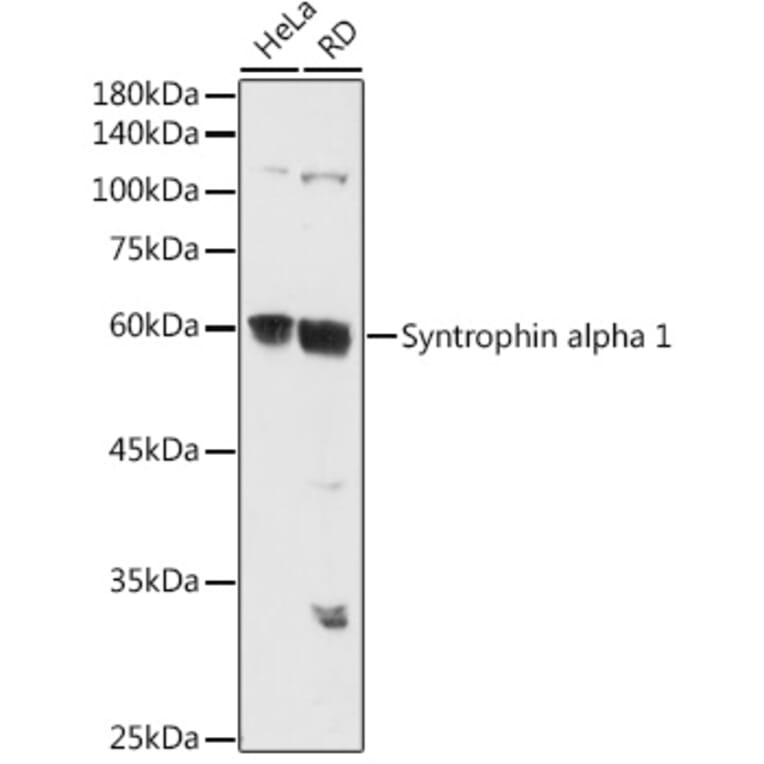 Western Blot - Anti-Syntrophin alpha 1 Antibody (A307015) - Antibodies.com