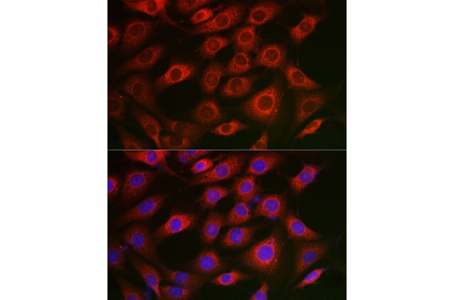 Immunofluorescence - Anti-Syntrophin alpha 1 Antibody (A307015) - Antibodies.com
