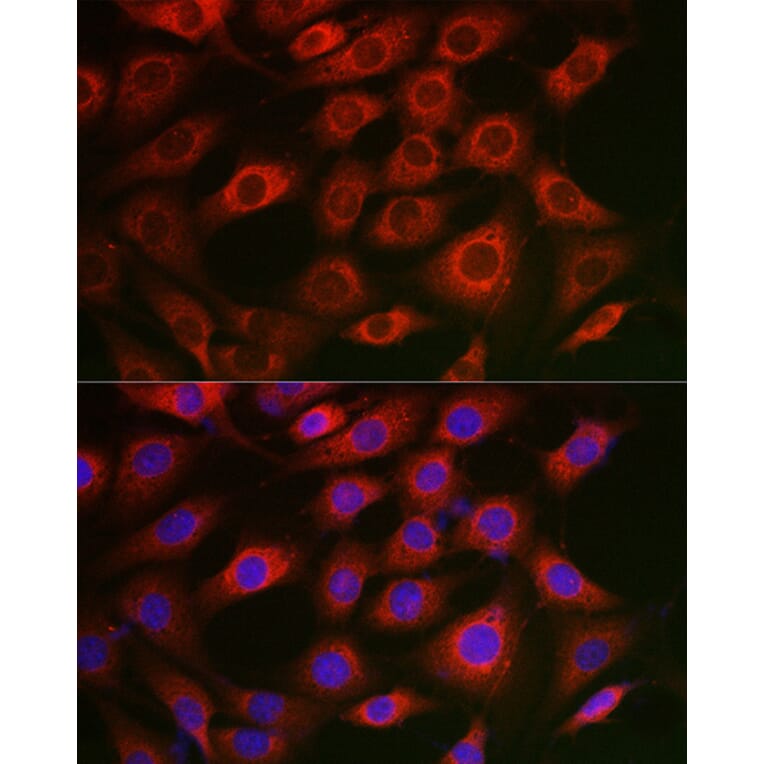 Immunofluorescence - Anti-Syntrophin alpha 1 Antibody (A307015) - Antibodies.com