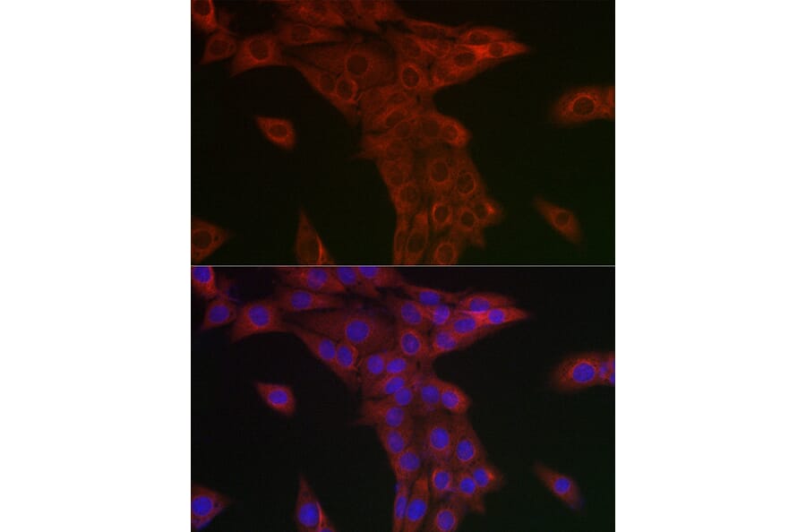 Immunofluorescence - Anti-Syntrophin alpha 1 Antibody (A307015) - Antibodies.com