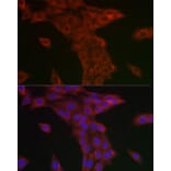 Immunofluorescence - Anti-Syntrophin alpha 1 Antibody (A307015) - Antibodies.com