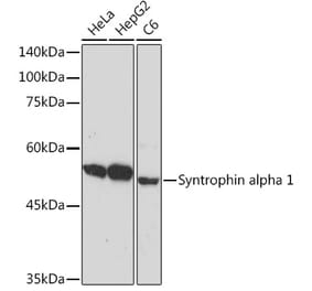 Western Blot - Anti-Syntrophin alpha 1 Antibody [ARC2286] (A307016) - Antibodies.com