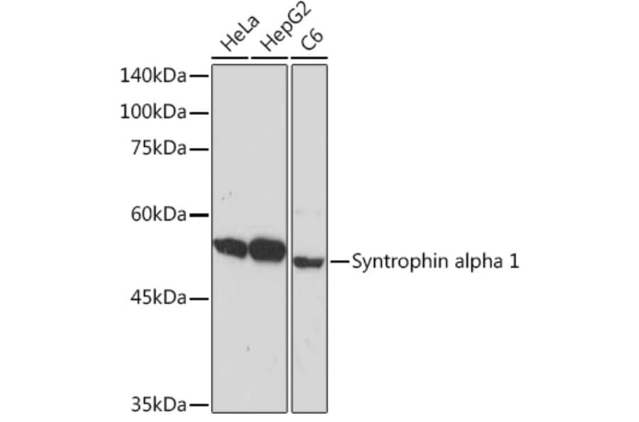 Western Blot - Anti-Syntrophin alpha 1 Antibody [ARC2286] (A307016) - Antibodies.com