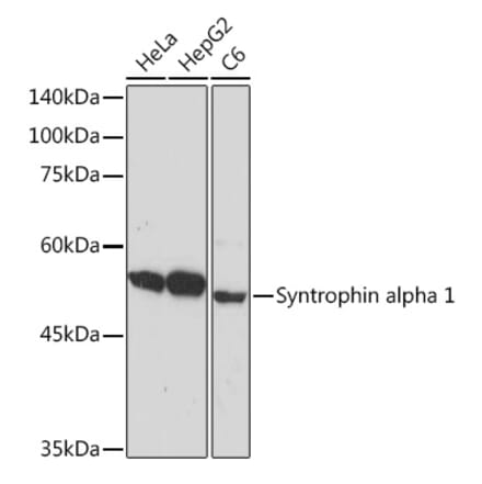 Western Blot - Anti-Syntrophin alpha 1 Antibody [ARC2286] (A307016) - Antibodies.com