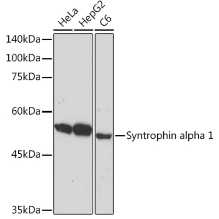 Western Blot - Anti-Syntrophin alpha 1 Antibody [ARC2286] (A307016) - Antibodies.com