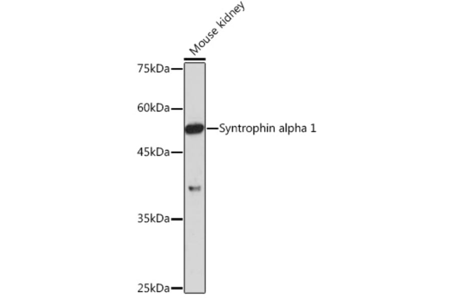 Western Blot - Anti-Syntrophin alpha 1 Antibody [ARC2286] (A307016) - Antibodies.com