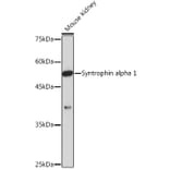 Western Blot - Anti-Syntrophin alpha 1 Antibody [ARC2286] (A307016) - Antibodies.com