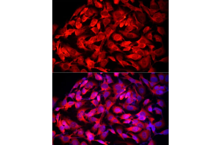 Immunofluorescence - Anti-MTAP Antibody (A307017) - Antibodies.com