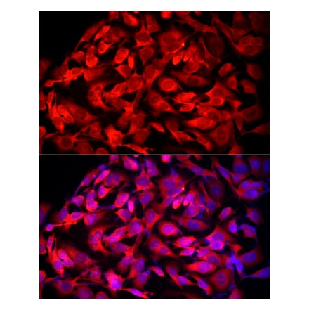 Immunofluorescence - Anti-MTAP Antibody (A307017) - Antibodies.com