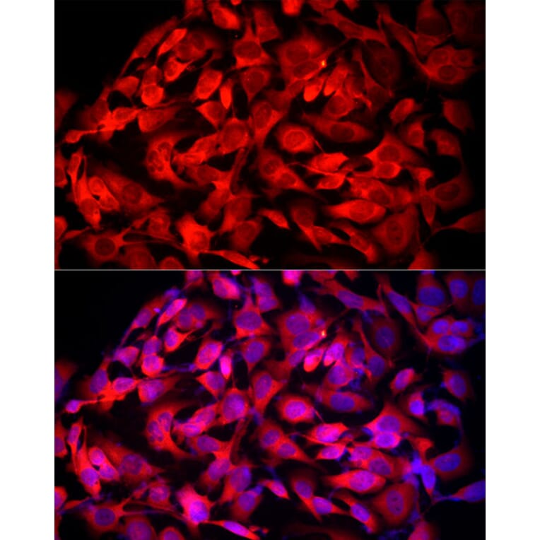 Immunofluorescence - Anti-MTAP Antibody (A307017) - Antibodies.com