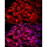 Immunofluorescence - Anti-MTAP Antibody (A307017) - Antibodies.com