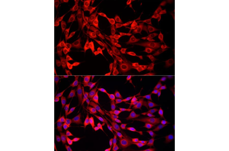 Immunofluorescence - Anti-MTAP Antibody (A307017) - Antibodies.com