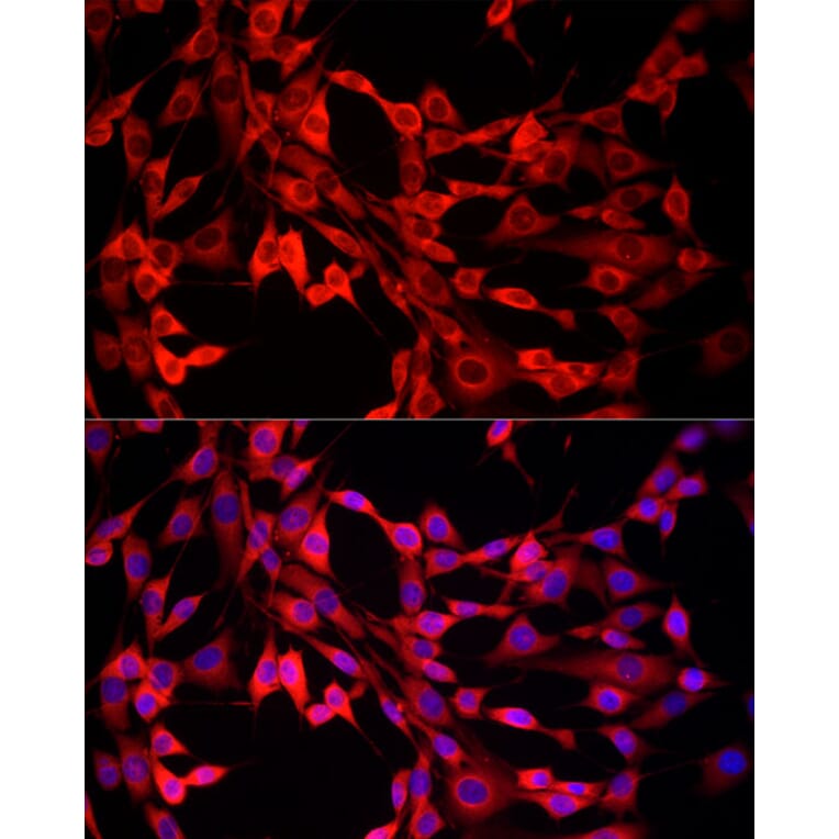 Immunofluorescence - Anti-MTAP Antibody (A307017) - Antibodies.com