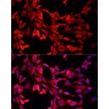 Immunofluorescence - Anti-MTAP Antibody (A307017) - Antibodies.com
