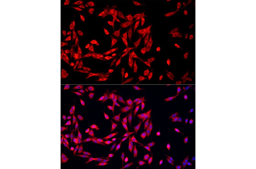 Immunofluorescence - Anti-MTAP Antibody (A307017) - Antibodies.com