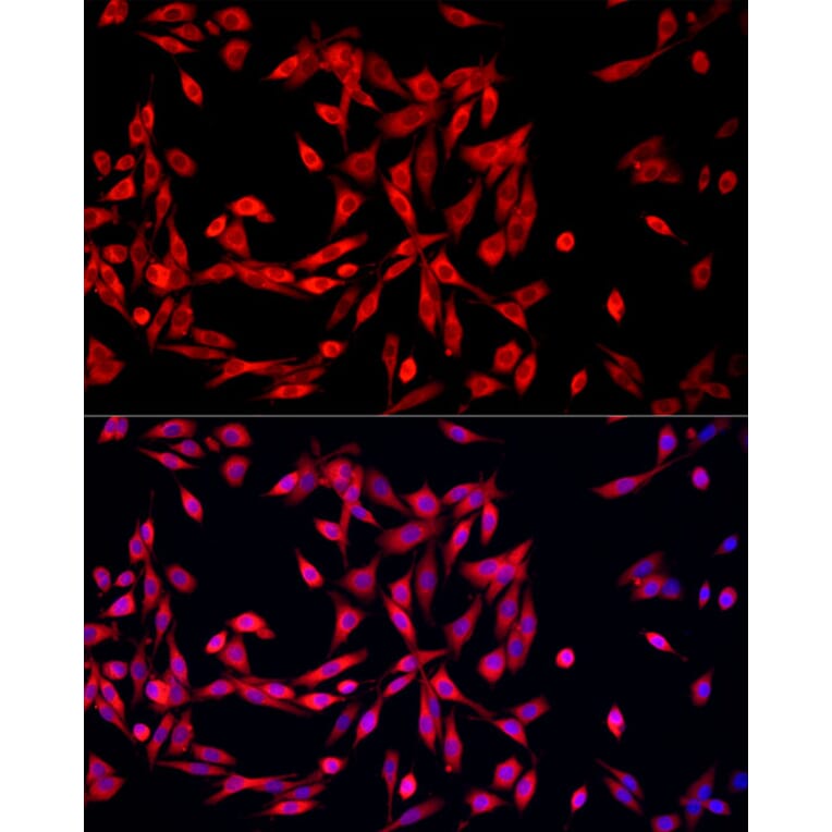 Immunofluorescence - Anti-MTAP Antibody (A307017) - Antibodies.com