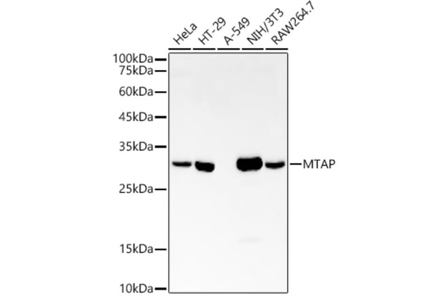 Western Blot - Anti-MTAP Antibody [ARC54717] (A307019) - Antibodies.com