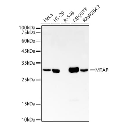 Western Blot - Anti-MTAP Antibody [ARC54717] (A307019) - Antibodies.com