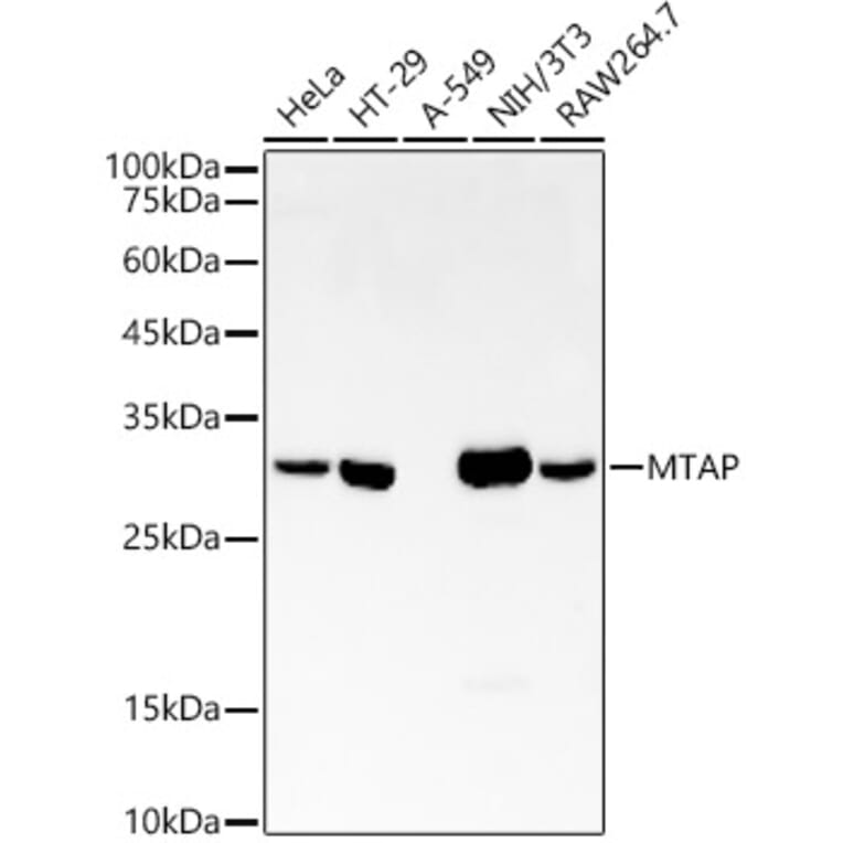 Western Blot - Anti-MTAP Antibody [ARC54717] (A307019) - Antibodies.com