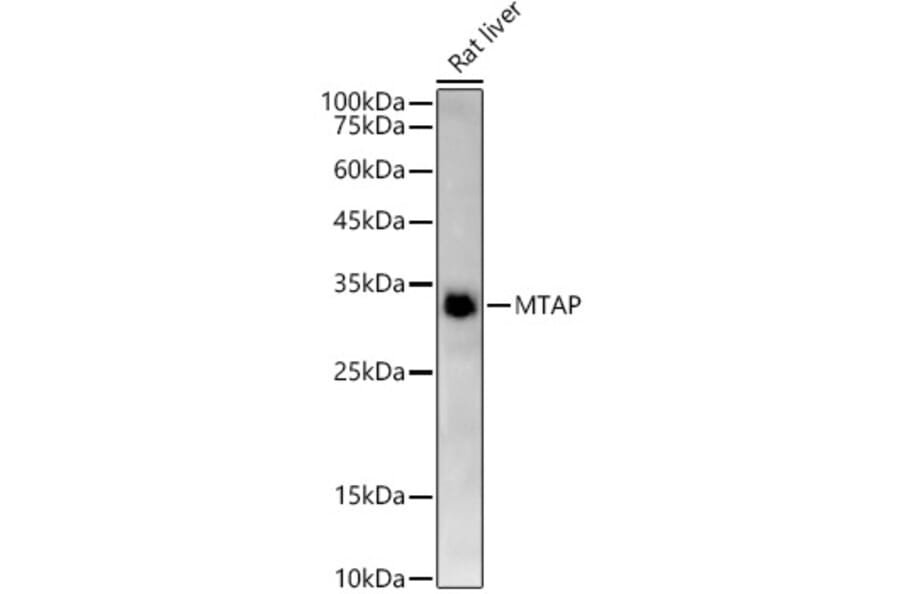 Western Blot - Anti-MTAP Antibody [ARC54717] (A307019) - Antibodies.com