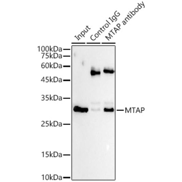 Western Blot - Anti-MTAP Antibody [ARC54717] (A307019) - Antibodies.com