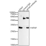 Western Blot - Anti-MTAP Antibody [ARC54717] (A307019) - Antibodies.com