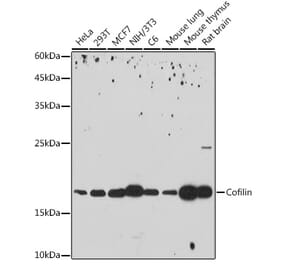 Western Blot - Anti-Cofilin Antibody [ARC2615] (A307020) - Antibodies.com