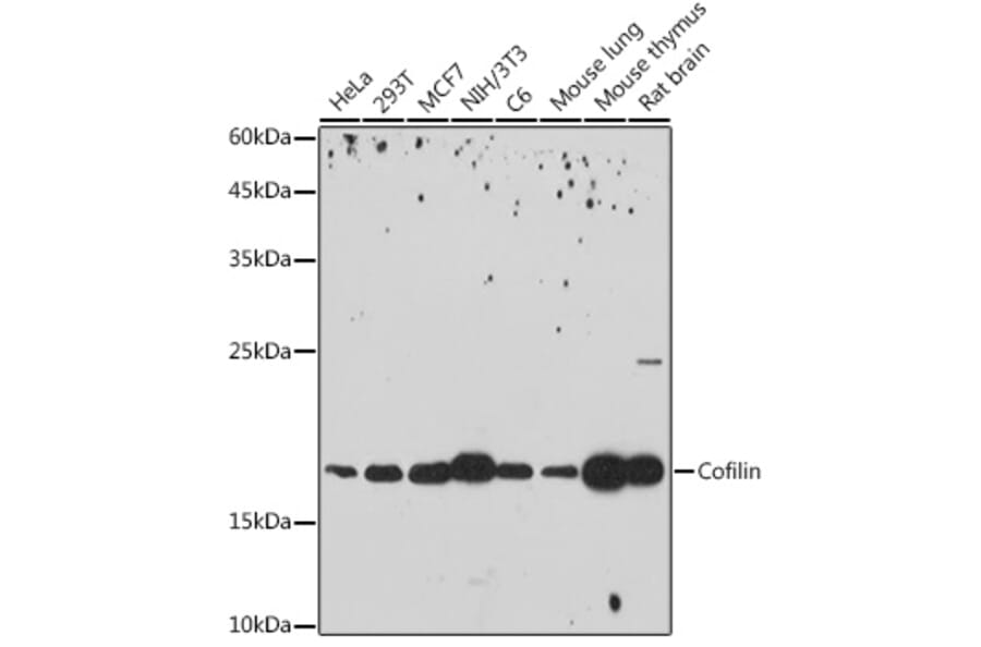 Western Blot - Anti-Cofilin Antibody [ARC2615] (A307020) - Antibodies.com