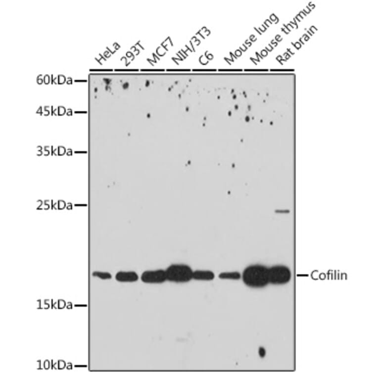 Western Blot - Anti-Cofilin Antibody [ARC2615] (A307020) - Antibodies.com