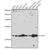 Western Blot - Anti-Cofilin Antibody [ARC2615] (A307020) - Antibodies.com