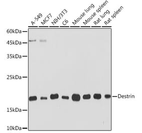 Western Blot - Anti-DSTN Antibody [ARC2297] (A307021) - Antibodies.com