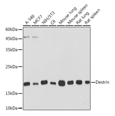 Western Blot - Anti-DSTN Antibody [ARC2297] (A307021) - Antibodies.com