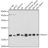 Western Blot - Anti-DSTN Antibody [ARC2297] (A307021) - Antibodies.com