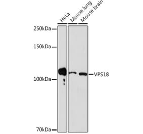 Western Blot - Anti-VPS18 Antibody [ARC2156] (A307022) - Antibodies.com