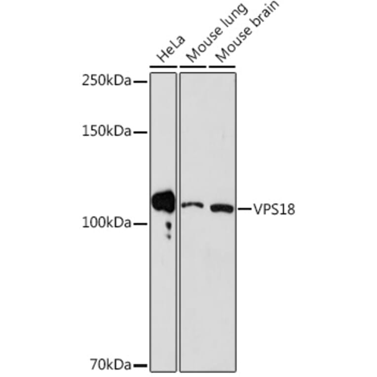 Western Blot - Anti-VPS18 Antibody [ARC2156] (A307022) - Antibodies.com