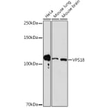 Western Blot - Anti-VPS18 Antibody [ARC2156] (A307022) - Antibodies.com