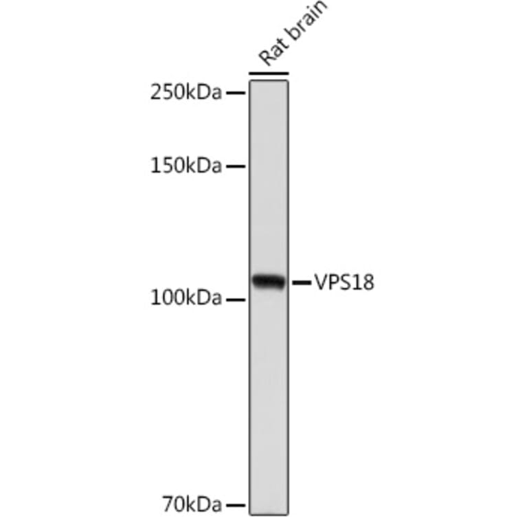 Western Blot - Anti-VPS18 Antibody [ARC2156] (A307022) - Antibodies.com